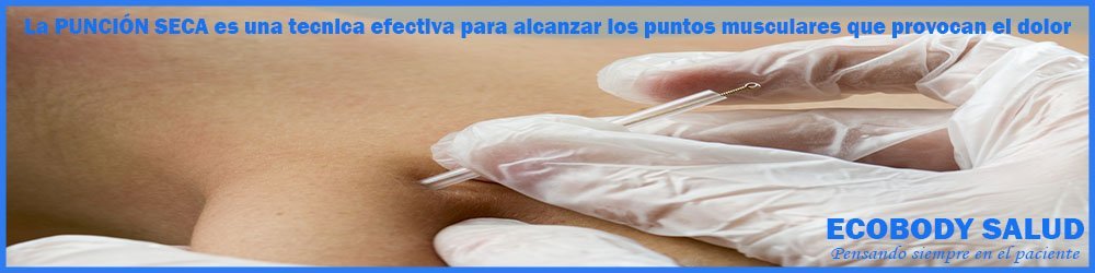 Puncion seca para contracturas musculares
